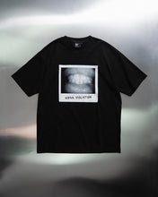 Smile Dog T-Shirt + HIPAA VIOLATION T-Shirt